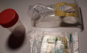Infectia urinara la copil-semne, simptome, cum se recolteaza urina